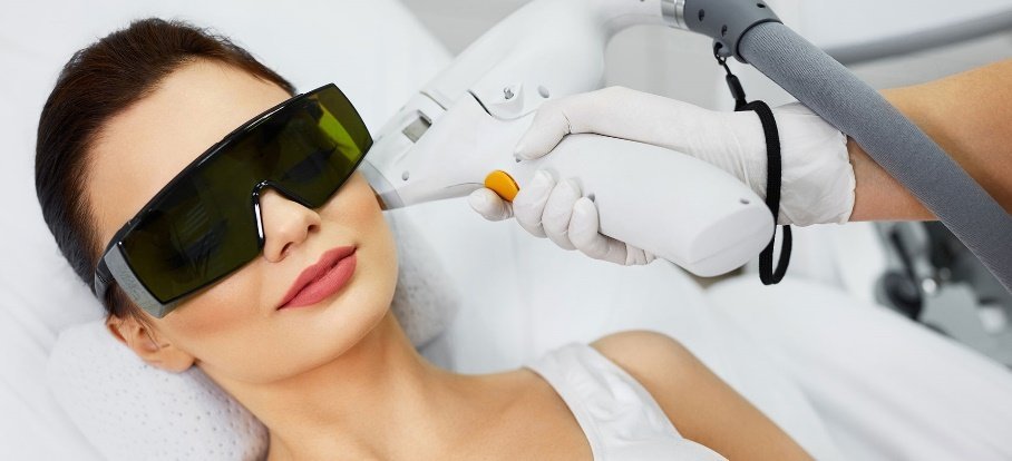 Ποιο Laser αποτρίχωσης να επιλέξω;